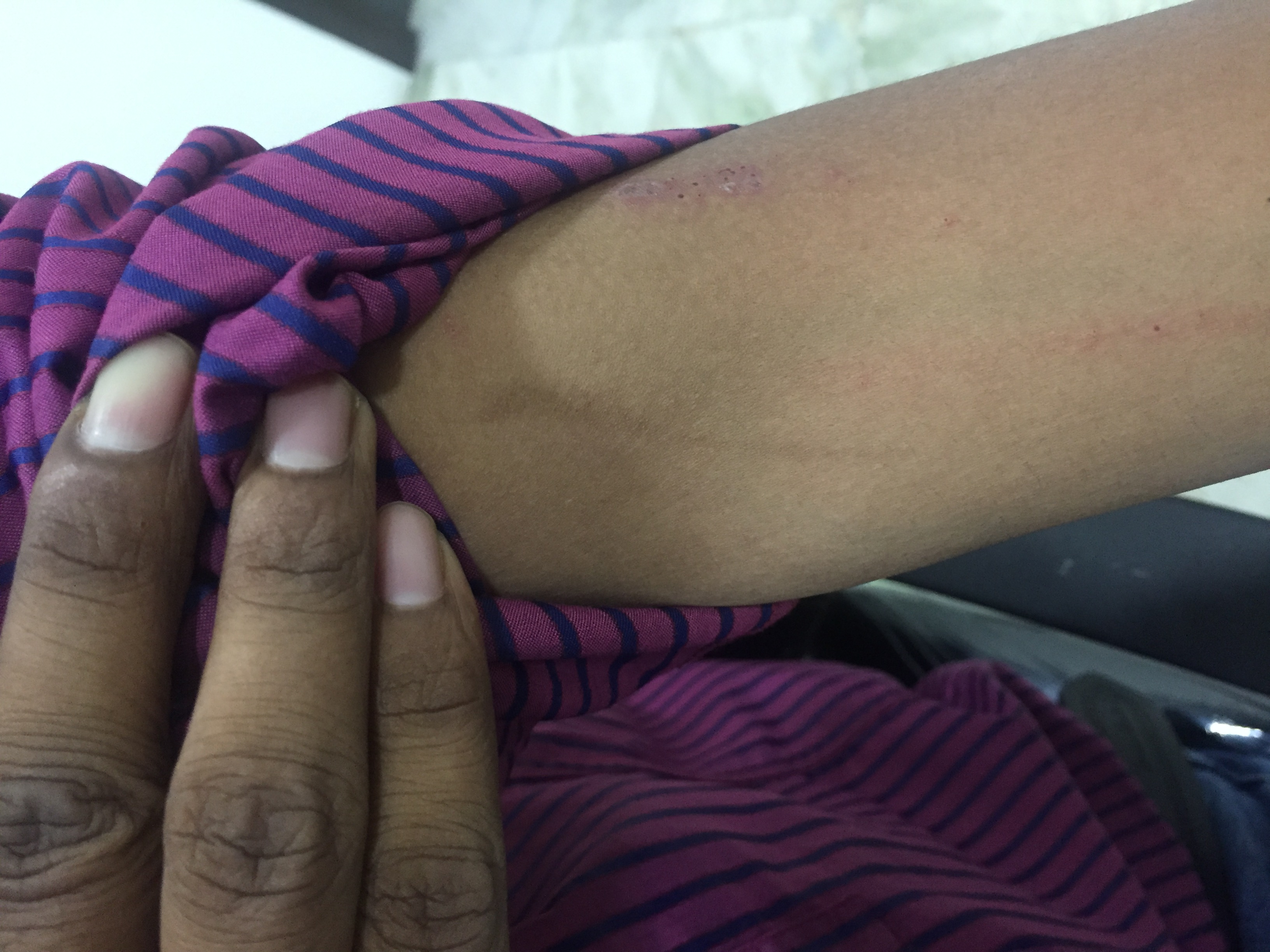 Diagnose This Case In Assamese Boy